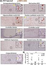 Phospho-Nrf2 (Ser40) Antibody in Immunohistochemistry (IHC)