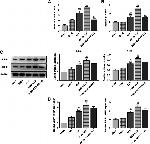 SPHK1 Antibody in Western Blot (WB)