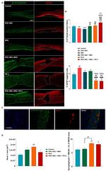 GFAP Antibody in Immunohistochemistry (Paraffin) (IHC (P))