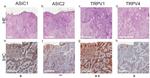 TRPV1 Antibody in Immunohistochemistry (IHC)