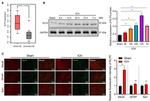 KLF6 Antibody in Western Blot (WB)