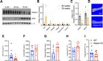 Adiponectin Antibody in Western Blot (WB)