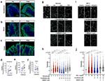 Claudin 1 Antibody in Immunohistochemistry (Paraffin) (IHC (P))