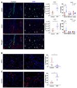 CD31 Antibody in Immunocytochemistry (ICC/IF)