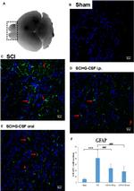 GFAP Antibody in Immunohistochemistry (IHC)