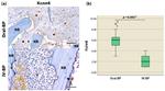 KCNN4 Antibody in Immunohistochemistry (IHC)