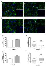 beta Catenin Antibody in Immunocytochemistry (ICC/IF)