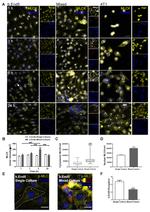 MYLK Antibody in Immunocytochemistry (ICC/IF)