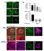 Thrombospondin 1 Antibody in Immunohistochemistry (IHC)