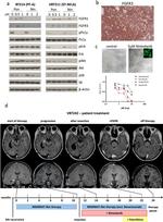 FGFR3 Antibody in Immunohistochemistry (IHC)