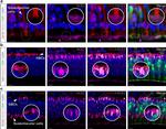 ACE2 Antibody in Immunohistochemistry (IHC)