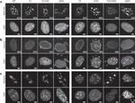 Fibrillarin Antibody in Immunocytochemistry (ICC/IF)