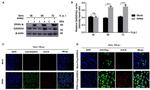 GADD34 Antibody in Immunocytochemistry (ICC/IF)