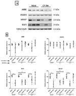 AIRE Antibody in Western Blot (WB)