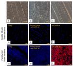 Calcium Sensing Receptor Antibody in Immunocytochemistry (ICC/IF)