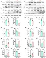 Lamin B1 Antibody in Western Blot (WB)