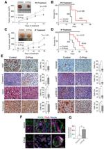 Vimentin Antibody in Immunohistochemistry (IHC)