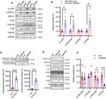 beta Amyloid Antibody in Western Blot (WB)