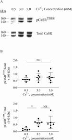 Calcium Sensing Receptor Antibody in Western Blot (WB)