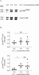 Calcium Sensing Receptor Antibody in Western Blot (WB)