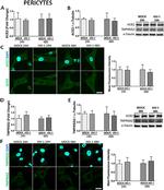 TMPRSS2 Antibody in Western Blot (WB)