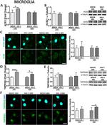 TMPRSS2 Antibody in Western Blot (WB)