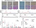 Myeloperoxidase Antibody in Immunohistochemistry (IHC)