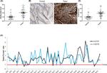 ALOX5 Antibody in Immunohistochemistry (Paraffin) (IHC (P))