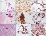 AFP Antibody in Immunohistochemistry (IHC)