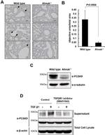 PCSK9 Antibody in Western Blot, Immunohistochemistry (WB, IHC)