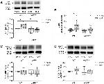 beta Amyloid Antibody in Western Blot (WB)