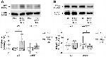 beta Amyloid Antibody in Western Blot (WB)