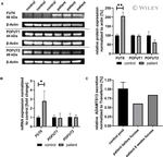 ADAMTS13 Antibody in Western Blot (WB)