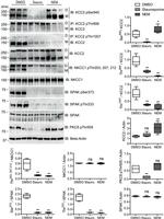 Phospho-KCC2 (Ser940) Antibody in Western Blot (WB)