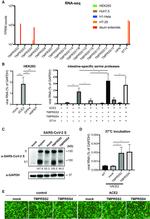 SARS/SARS-CoV-2 Coronavirus Spike Protein (subunit 1) Antibody in Western Blot (WB)