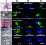 DAZL Antibody in Immunocytochemistry (ICC/IF)