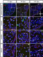 Acetyl-alpha Tubulin (Lys40) Antibody in Immunohistochemistry (IHC)