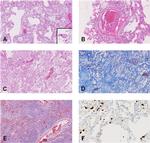 SARS Coronavirus Nucleocapsid Antibody in Immunohistochemistry (IHC)