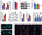 SEC61B Antibody in Immunocytochemistry (ICC/IF)