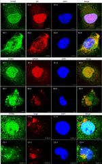 Calnexin Antibody in Immunocytochemistry (ICC/IF)