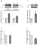 Glucocorticoid Receptor Antibody in Western Blot (WB)