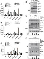 Androgen Receptor Antibody in Western Blot (WB)