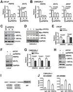 Androgen Receptor Antibody in Western Blot (WB)