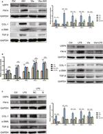 USP4 Antibody in Western Blot (WB)