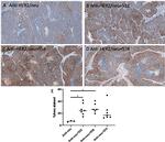 CD8 alpha Antibody in Immunohistochemistry (IHC)