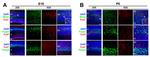 FZD7 Antibody in Immunocytochemistry, Immunohistochemistry (ICC/IF, IHC)