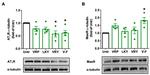 AGTR1 Antibody in Western Blot (WB)