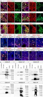 HDAC2 Antibody in Immunocytochemistry, Immunohistochemistry (Paraffin) (ICC/IF, IHC (P))