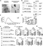 Calbindin D28K Antibody in Western Blot (WB)