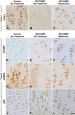 Phospho-AMPK alpha-1,2 (Thr172) Antibody in Immunohistochemistry (IHC)